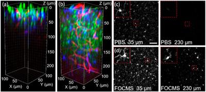 FOCMS: An ultrafast optical clearing method with quantified analysis